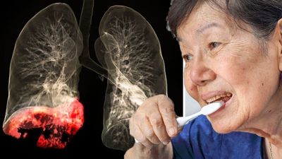 2022/09/Poor-dental-hygiene-could-put-you-at-risk-of-lung-900x500-1.jpg