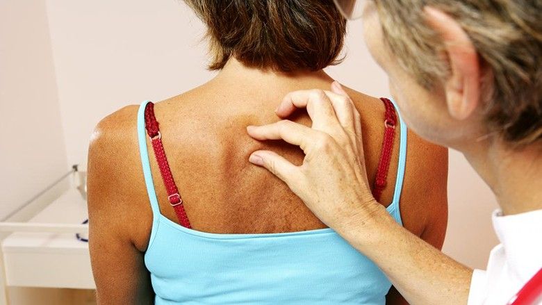 2016/08/dermatologist-inspecting-hard-lump-under-persons-skin-on-back.jpg