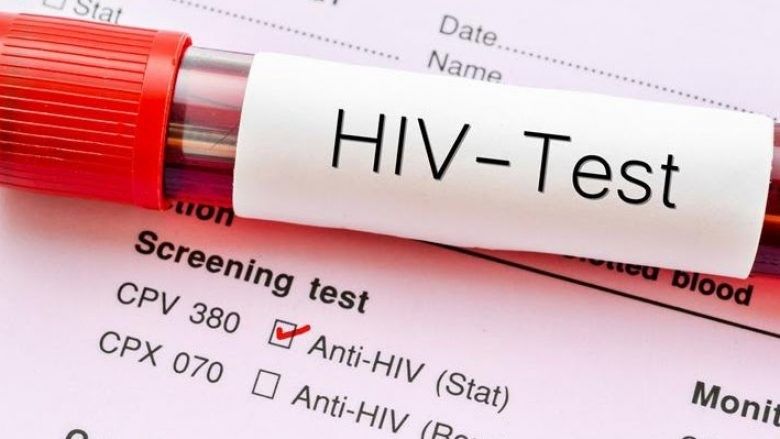 2024/03/HIV-test-aids-generic-780x439-1.jpg