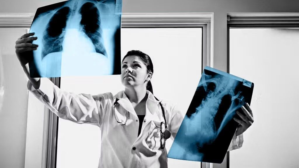 2024/05/doctor-holding-chest-xrays-1296x728-header-1024x575-1.jpg