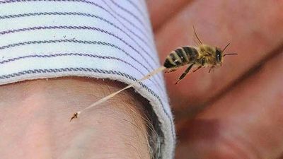 2024/08/anatomy-of-a-bee-sting-copy.jpg