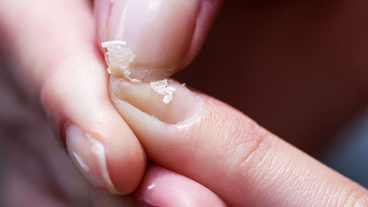 A janë thonjtë tuaj të brishtë? Forcojini ato me këto ushqime