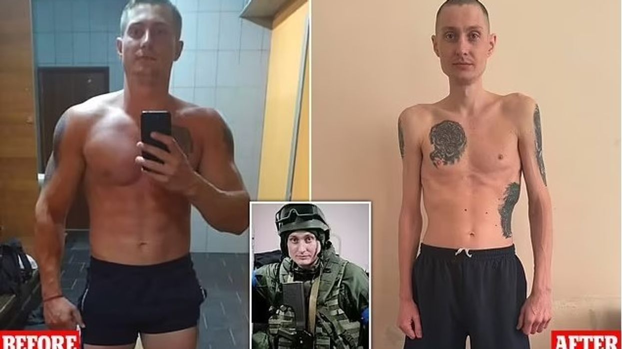 Para dhe pas qëndrimit në burg të Rusisë, ushtari ukrainas humb 40 kilogramë nga trajtimi çnjerëzor që i është bërë