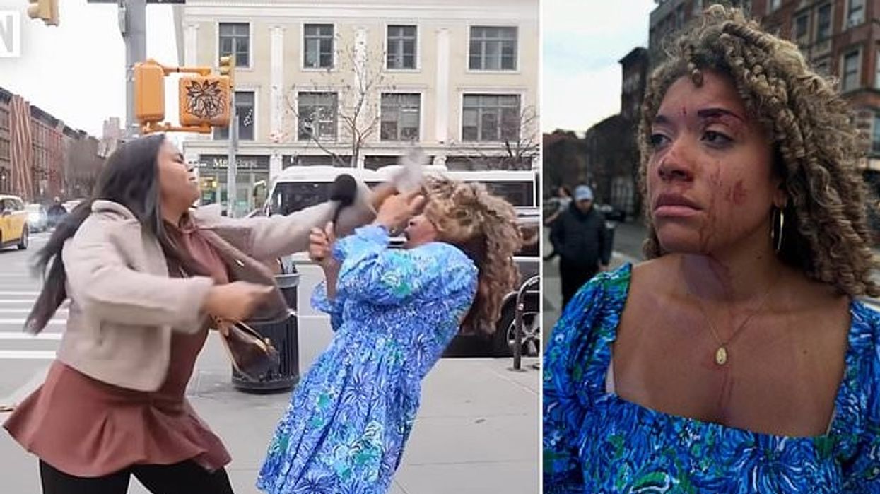 Aktivistja goditet në fytyrë nga një grua që po e intervistonte rrugëve të Nju Jorkut