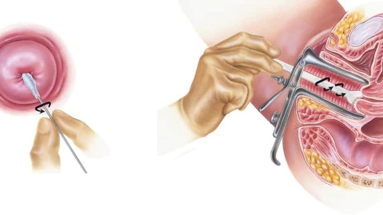 PAP testi tashmë ofrohet falas në AMF Gurrakoc për gratë e Komunës së Istogut