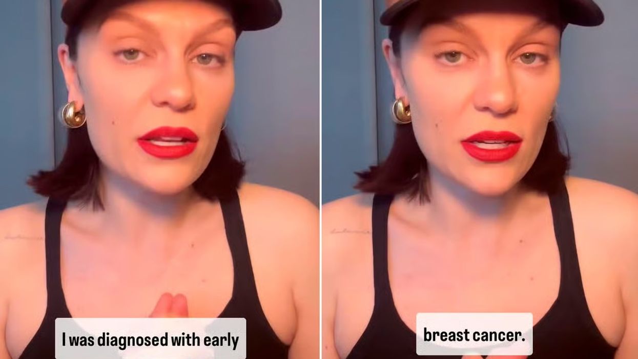 Jessie J ndan lajmin tronditës me fansat - zbulon se është diagnostikuar me kancer në gji
