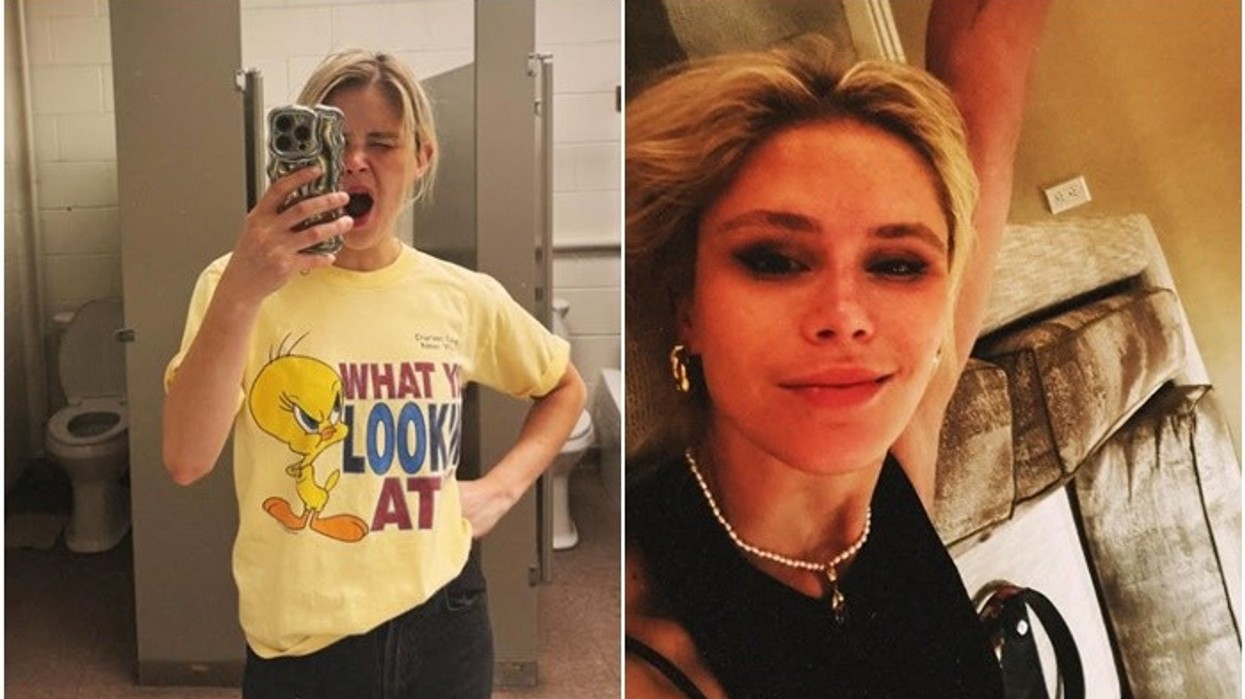 Aktorja Erin Moriarty zbulon se vuan nga sëmundja Graves