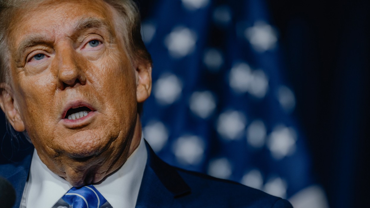 Trump u diagnostikua me pamjaftueshmëri kronike venoze – sa serioze është gjendja e tij?