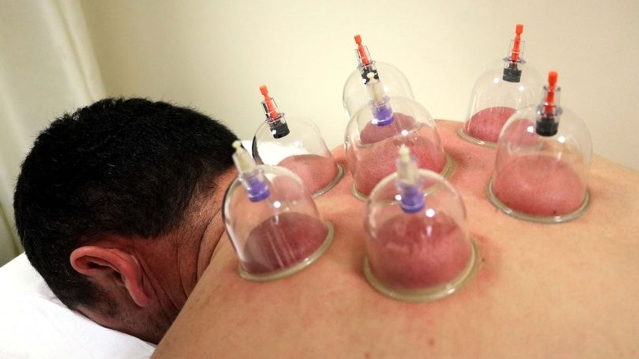 'Hixhama', terapia e njohur shekullore që çliron trupin po integrohet në spitalet turke