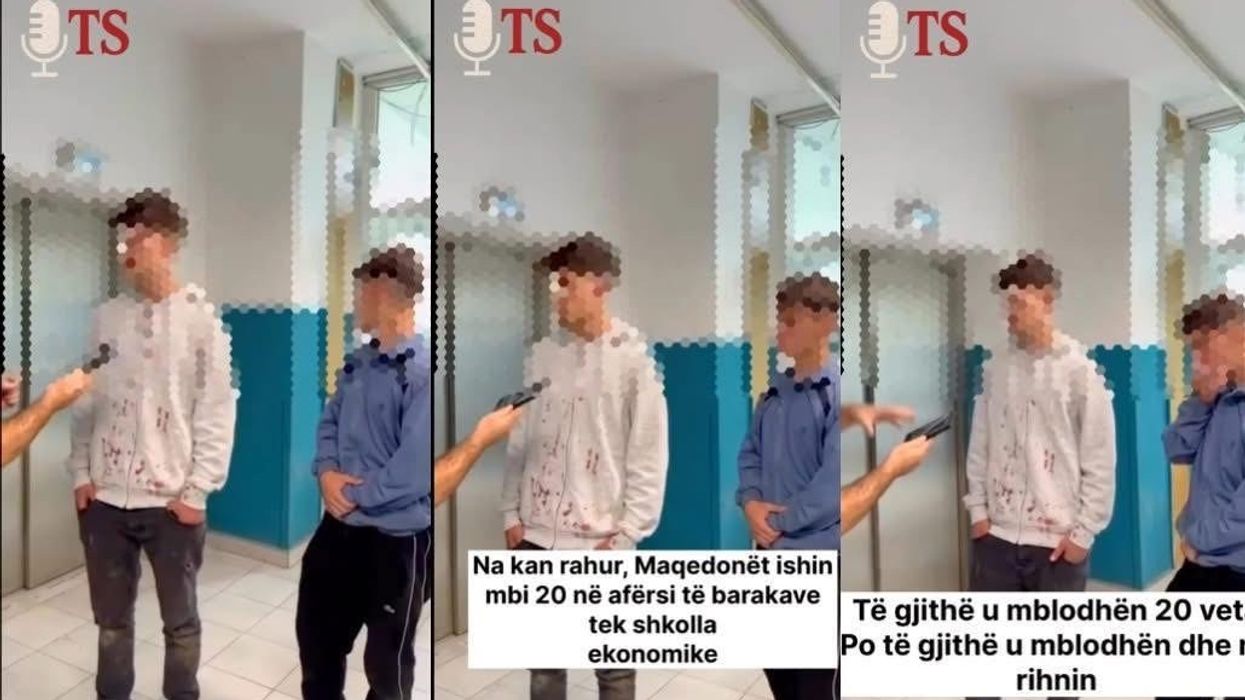 Sulmohen fizikisht dy të rinj në Tetovë - policia nis hetimet, partitë politike dalin me reagim