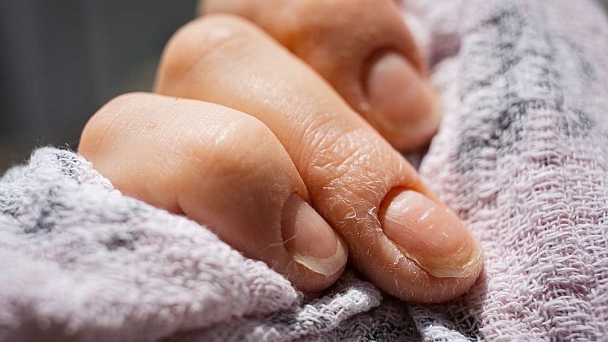 Ja si ta kuptoni që trupit tuaj i mungojnë proteinat