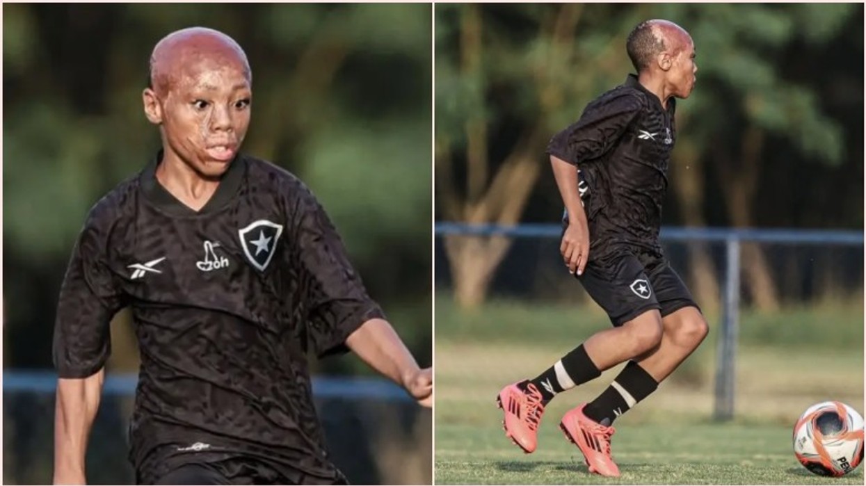 Kapërcimi i sfidave: Si 11-vjeçari Bernardo Lopes transformoi tragjedinë në ëndërr futbolli