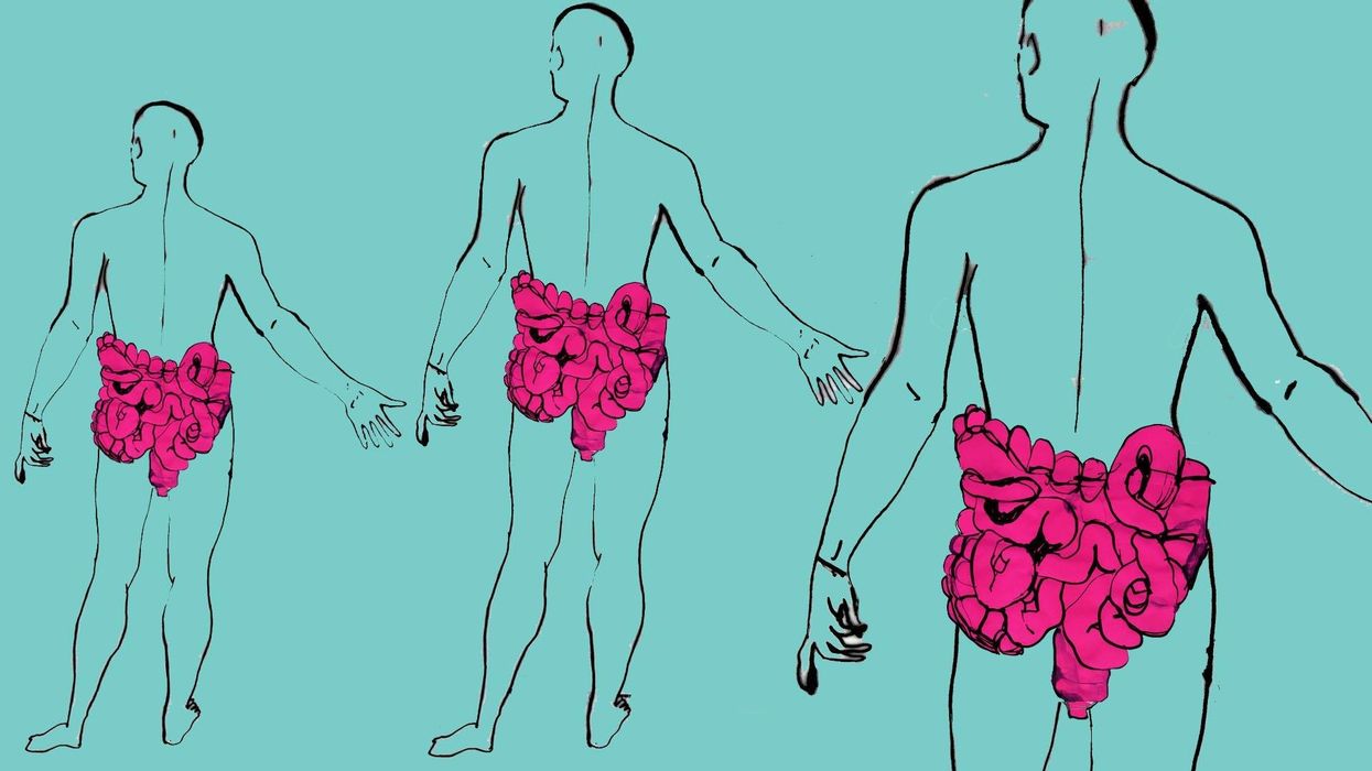 Klostridiumi “bakteri i fshehur” në zorrë – si ta parandaloni rikthimin e infeksionit