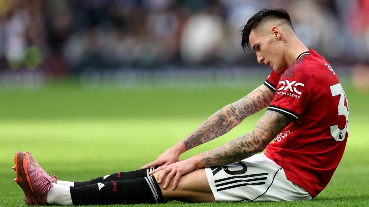 Zbulohet sa kohë do të mungojë Sesko pas lëndimit që do ia pamundësojë të luajë ndaj Kosovës