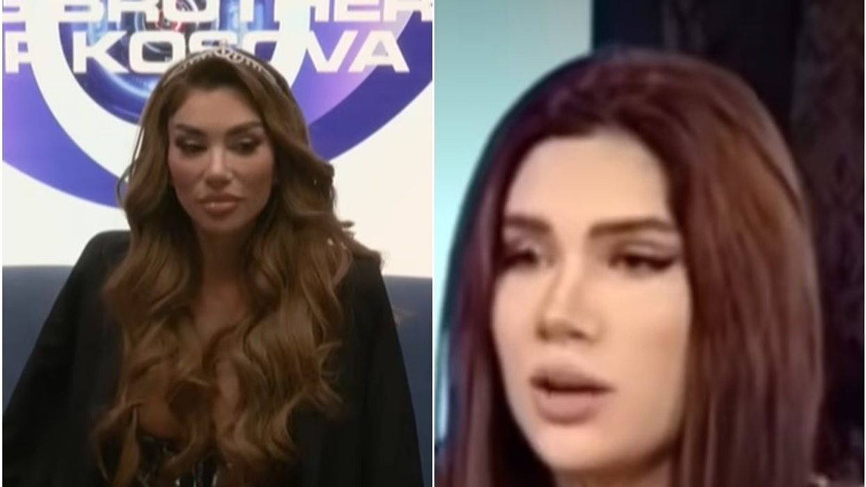 Publikohen pamjet se si dukej Bia Khalifa përpara ndërhyrjeve në fytyrë