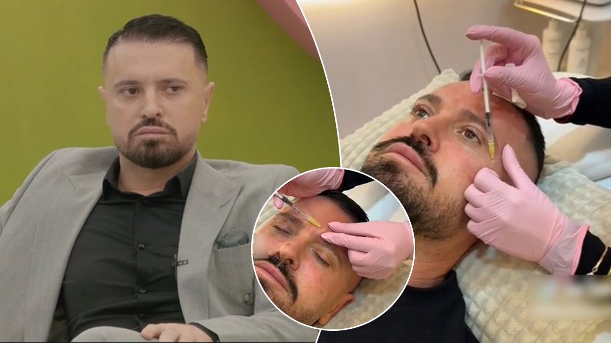 Publikohen pamjet e Labinot Rexhës duke injektuar botoks në fytyrë para se të hynte në Big Brother VIP Kosova 4 Publikohen pamjet e Labinot Rexhës duke injektuar botoks në fytyrë para se të hynte në Big Brother VIP Kosova 4