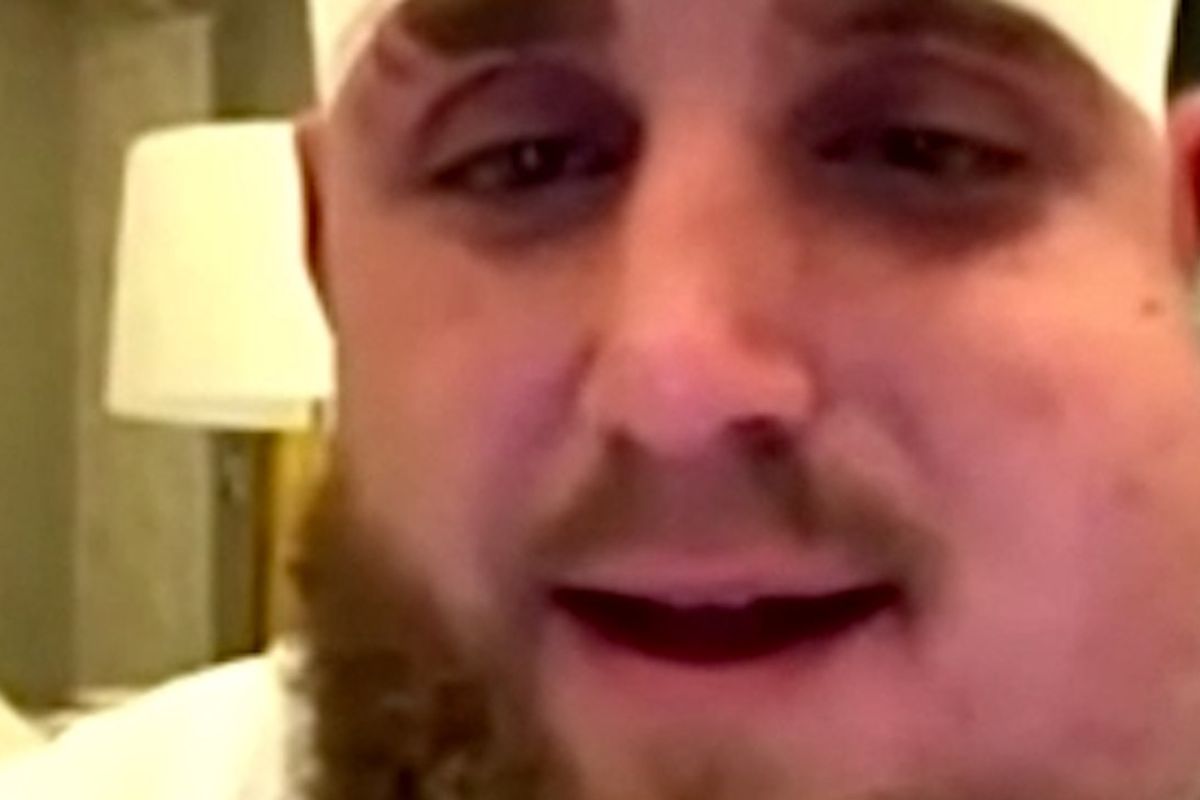 Pamje tronditëse të fytyrës së Jake Paulit pas operimit nga nokauti i Joshuas Pamje tronditëse të fytyrës së Jake Paulit pas operimit nga nokauti i Joshuas