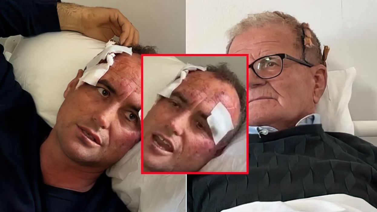 "Je bërë shumë e bukur", mërgimtari rrihet nga polici në Fier se i komentoi së motrës