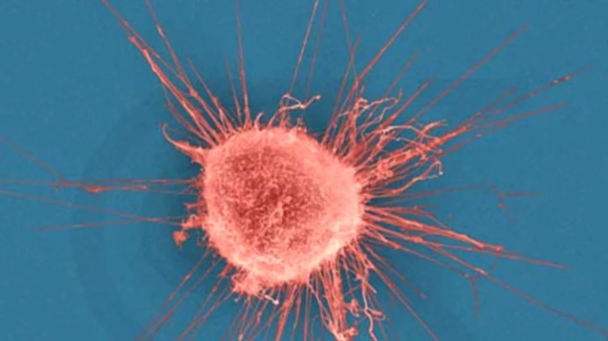 Ligjëratë informuese në Drenas në kuadër të Javës së Ndërgjegjësimit për Kancerin e Qafës së Mitrës