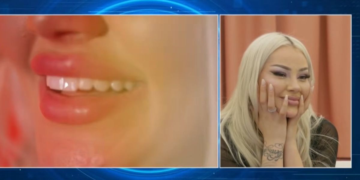 "Ma përmendin Dubain", Benita tregon për herë të parë se si i pagoi dhëmbët e diamantit në vlerë 18 mijë euro