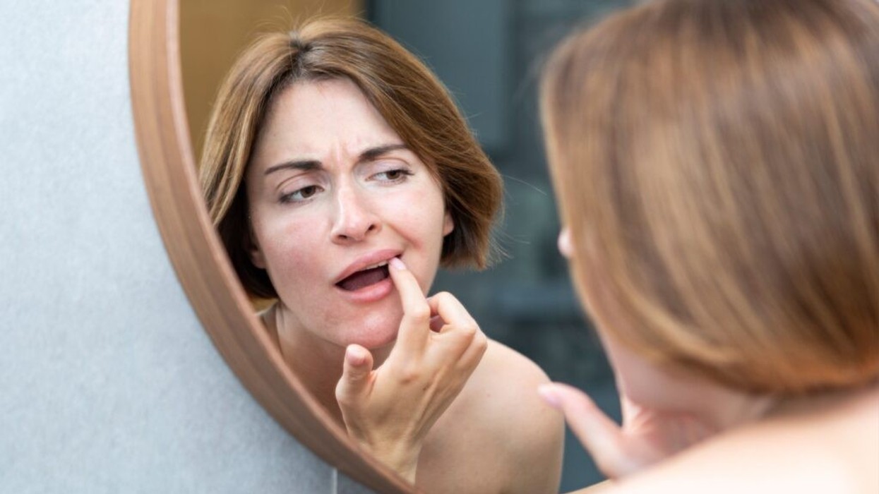 Erozioni i smaltit, era e keqe e gojës dhe aftet nuk janë gjithmonë pasojë e higjienës së dobët – si ndikojnë hormonet në dhëmbë?