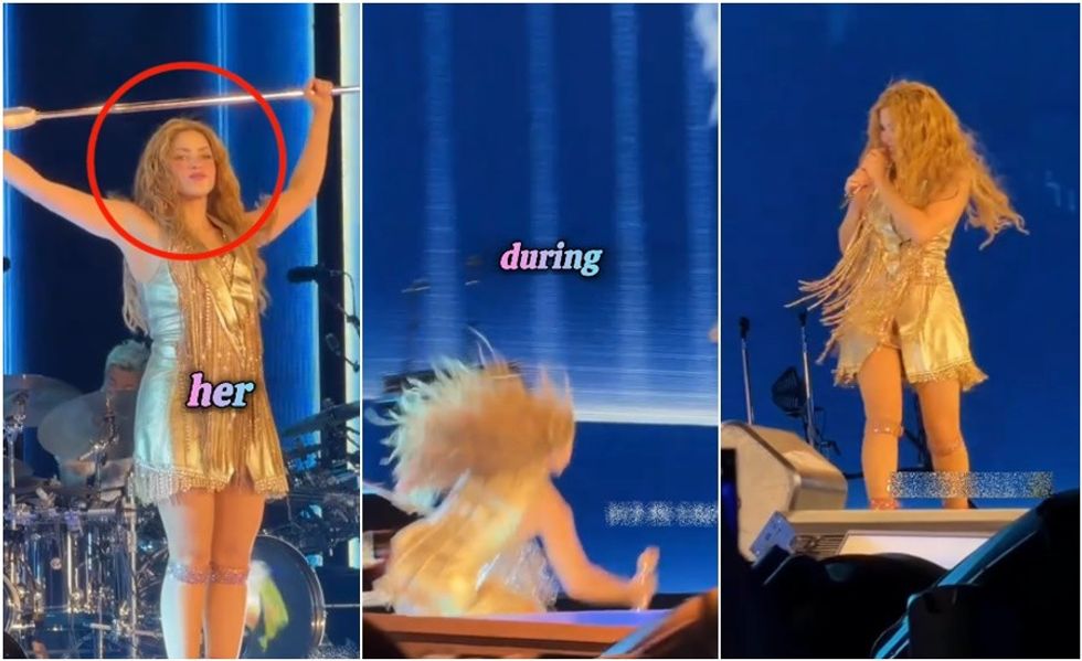 Shakira pëson incident në koncert: përdredh kyçin e dorës dhe rrëzohet në skenë