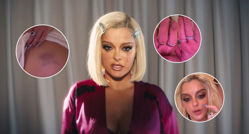 Xhiroi 13 klipe brenda tri ditësh, Bebe Rexha tregon pasojat në trupin dhe shëndetin e saj