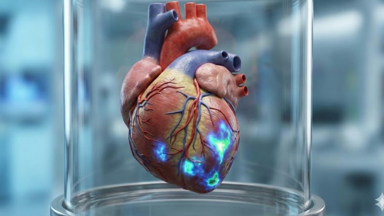 Zemra e njeriut mund të rigjenerojë qelizat e veta muskulore pas infarktit, zbulojnë studiuesit