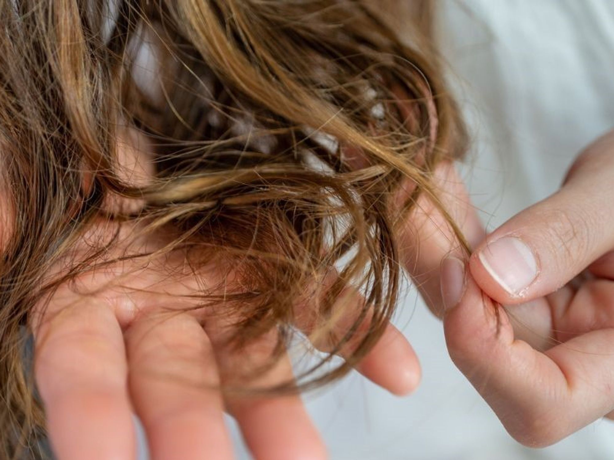 Një mostër floku mund të ndihmojë në zbulimin e hershëm të Parkinsonit – ja çfarë tregojnë gjetjet Një mostër floku mund të ndihmojë në zbulimin e hershëm të Parkinsonit – ja çfarë tregojnë gjetjet
