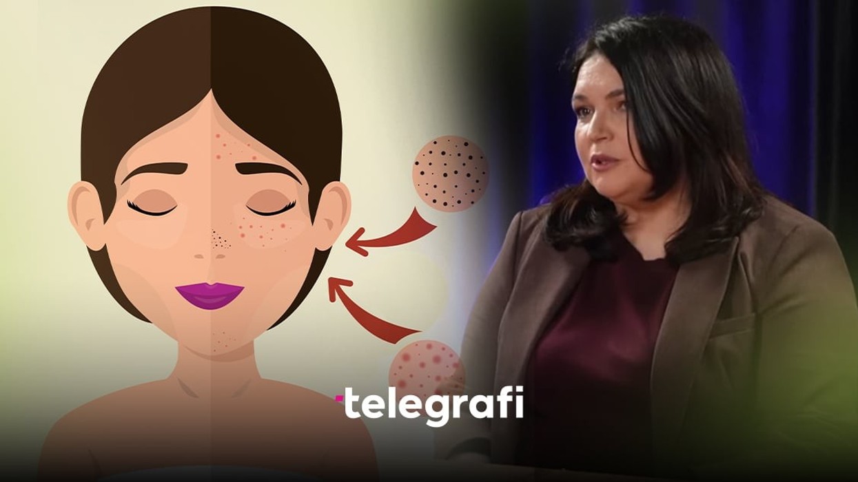 Dermatologia: Gabimi më i madh që bëjnë njerëzit me akne është përdorimi i shumë produkteve pa konsultë
