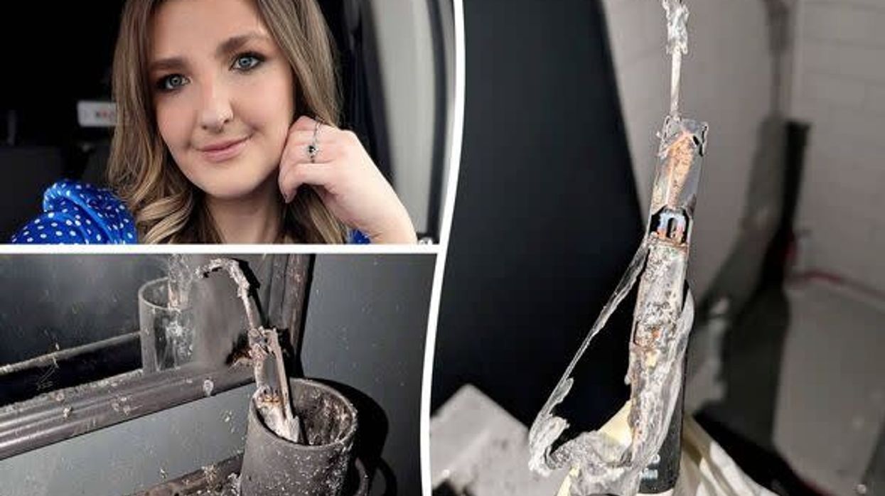 Gruaja thotë se është me fat që është gjallë' pasi i shpërtheu brusha elektrike e dhëmbëve Gruaja thotë se është me fat që është gjallë' pasi i shpërtheu brusha elektrike e dhëmbëve