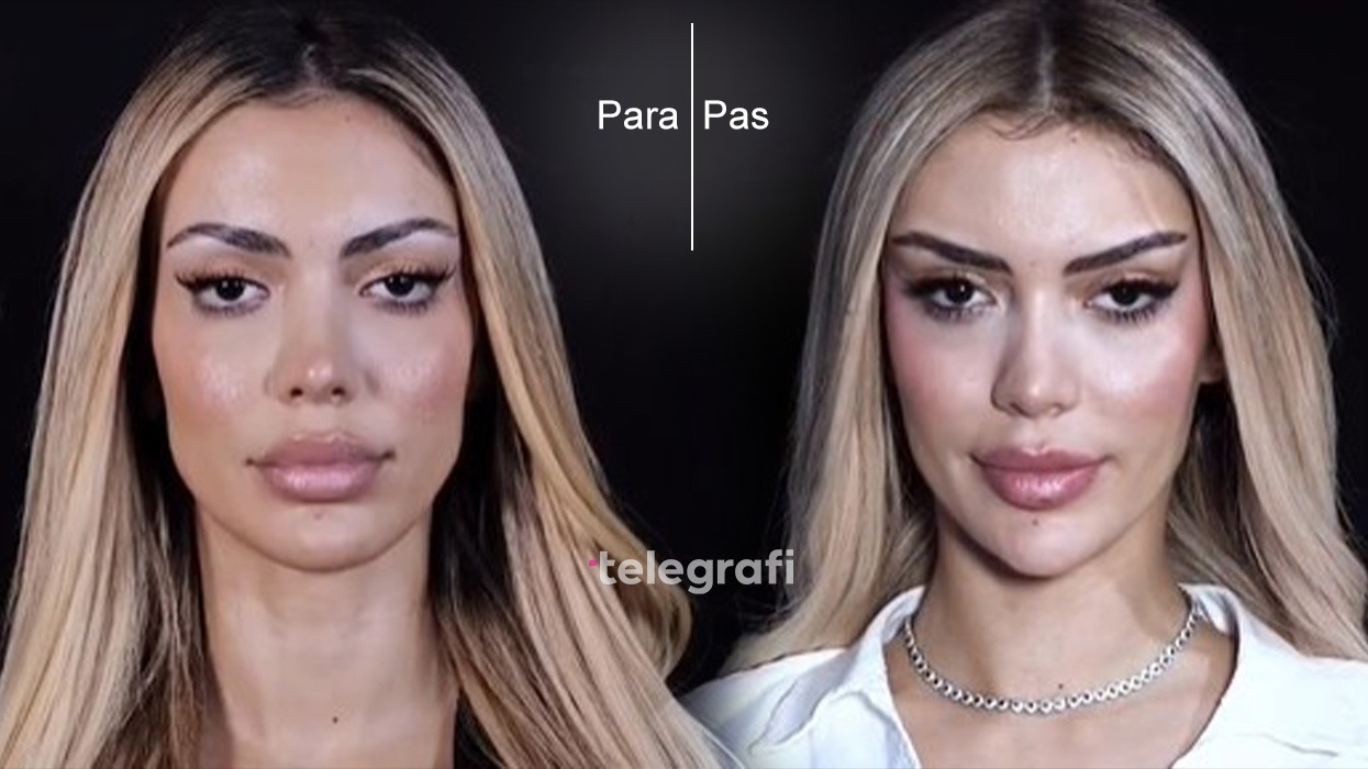 Publikohen pamjet e ndërhyrjeve të Brikenës para BBVA, reagime të shumta në rrjet