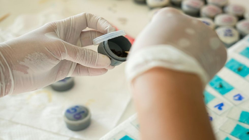 Kalprotektina fekale: Një test i vetëm tregon nëse keni inflamacion në zorrë apo jo