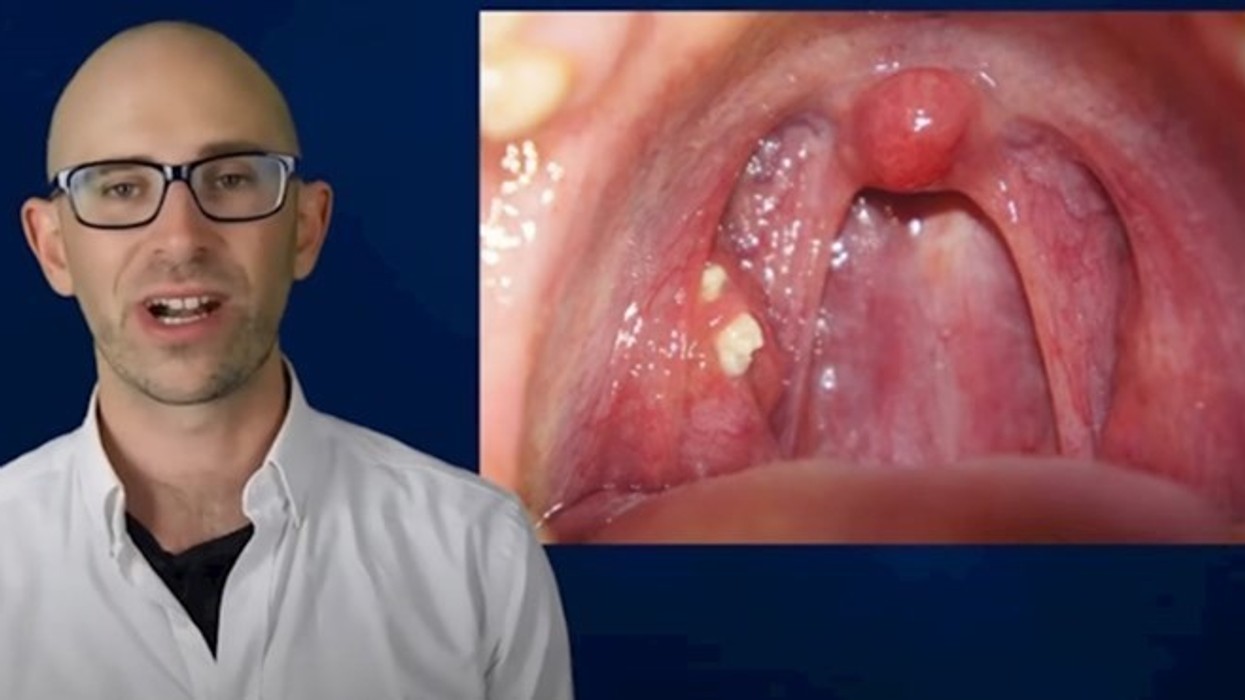 A keni vënë re këto pika të bardha në gojë?