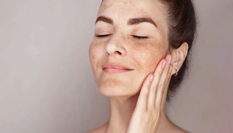 Njollat e errëta në fytyrë nuk zhduken vetë: Si t’i zbusni hiperpigmentimet dhe ta barazoni tenin