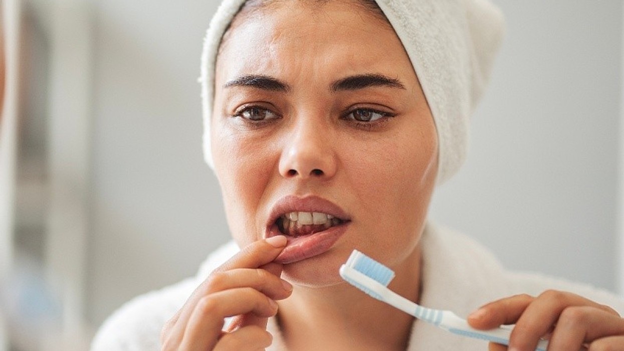 A ju rrjedhin shpesh gjak mishrat e dhëmbëve? Mungesa e kësaj vitamine mund të jetë shkaku