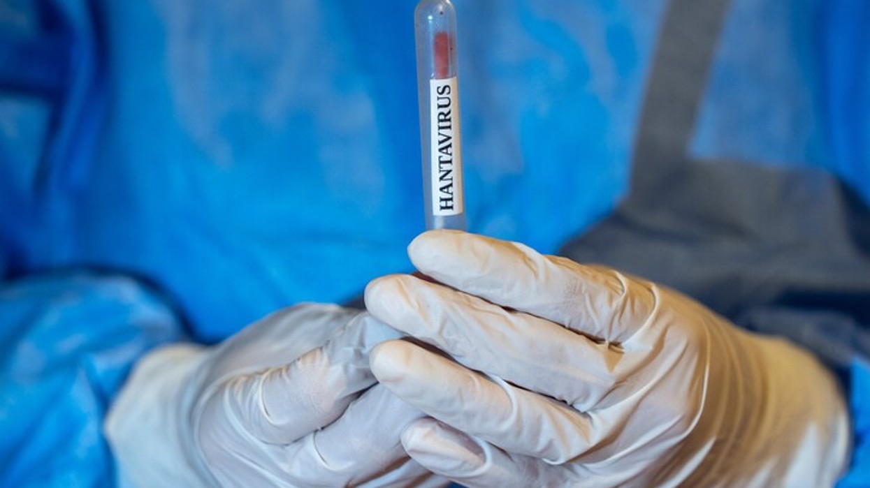 Franca konfirmon rastin e parë me hantavirus