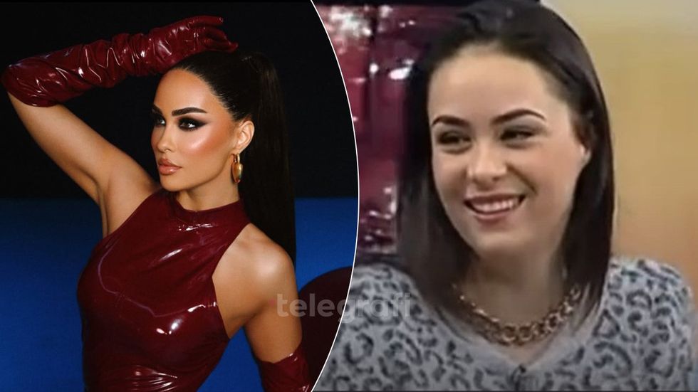 Rikthehet në rrjet një video e vjetër e Xhensila Myrtezajt për ndërhyrjet estetike: Do të bëj kur të jem 50 vjeçe