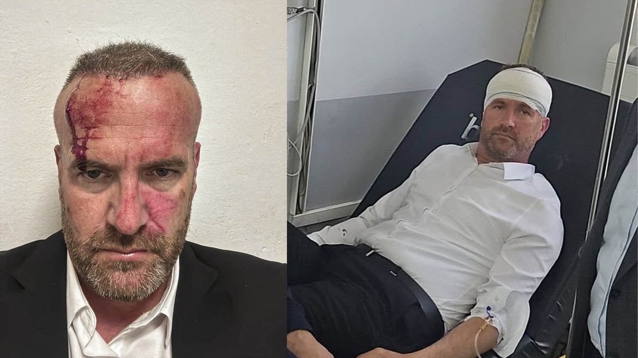 Prokuroria po interviston dëshmitarë dhe të dyshuar për incidentin në Skenderaj