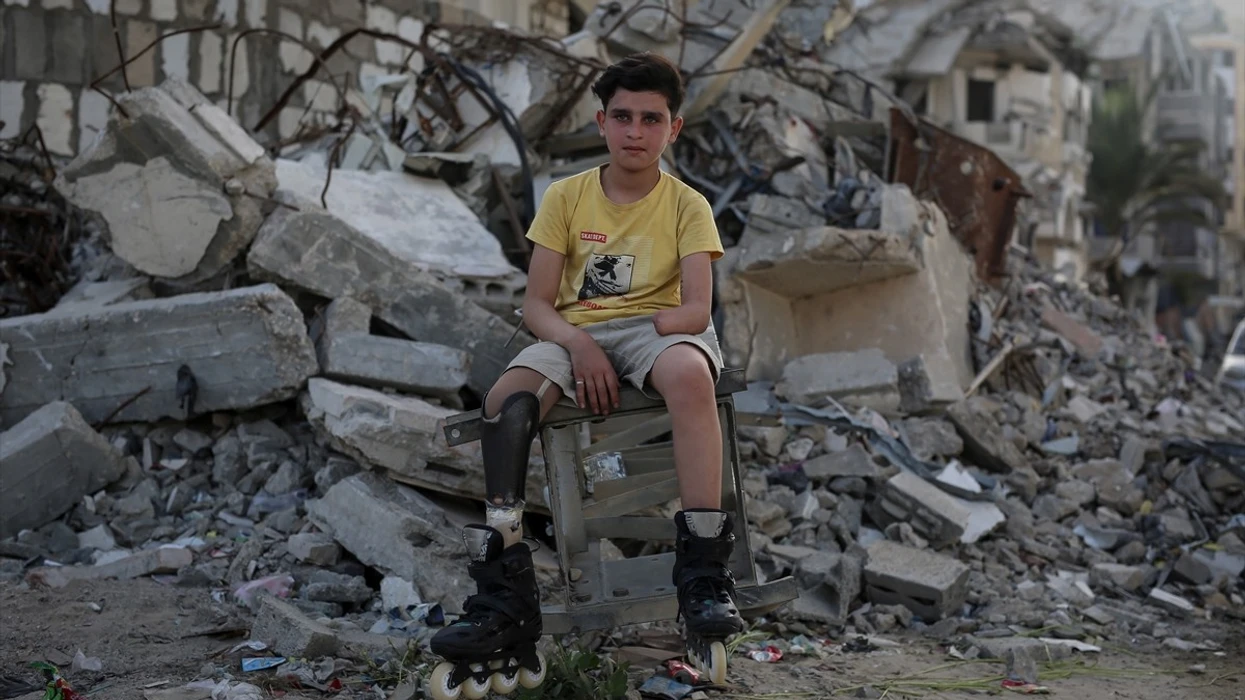 "Cili është mëkati im" - rrëfimi i dhimbshëm i 13-vjeçarit nga Palestina që humbi gjymtyrët në luftë