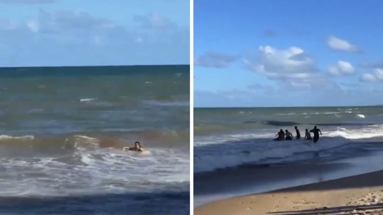 Peshkaqeni i kafshon këmbën një adoleshenteje braziliane, një ditë pasi një djalë 11-vjeçar humbi gjithashtu një gjymtyrë në një sulm të ngjashëm Peshkaqeni i kafshon këmbën një adoleshenteje braziliane, një ditë pasi një djalë 11-vjeçar humbi gjithashtu një gjymtyrë në një sulm të ngjashëm