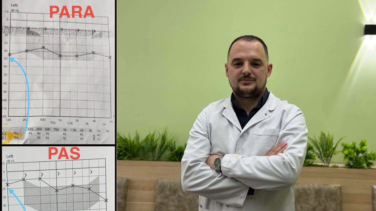 Mjeku nga Ferizaj i rikthen dëgjimin pacientit 23-vjeçar pas një timpanoplastike të suksesshme