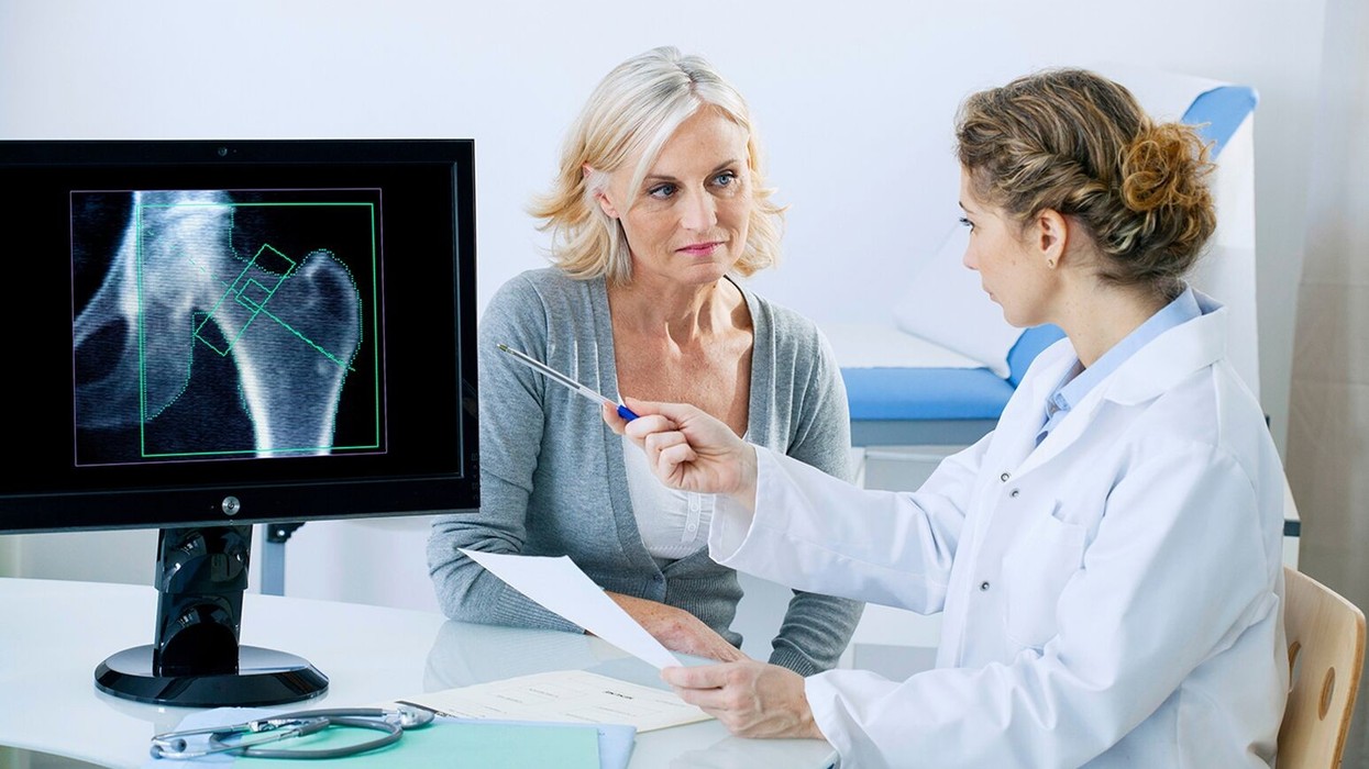 Menopauza dhe kockat: Studimi i ri zbulon një ulje të madhe të rrezikut