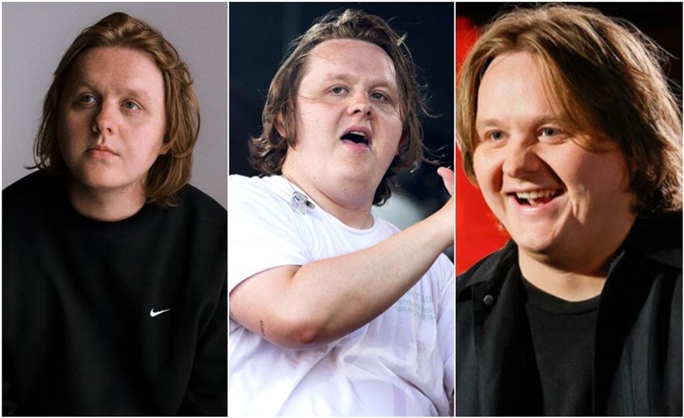 Lewis Capaldi në Sunny Hill Festival – historia e artistit që luftoi me shëndetin dhe pushtoi botën me muzikë