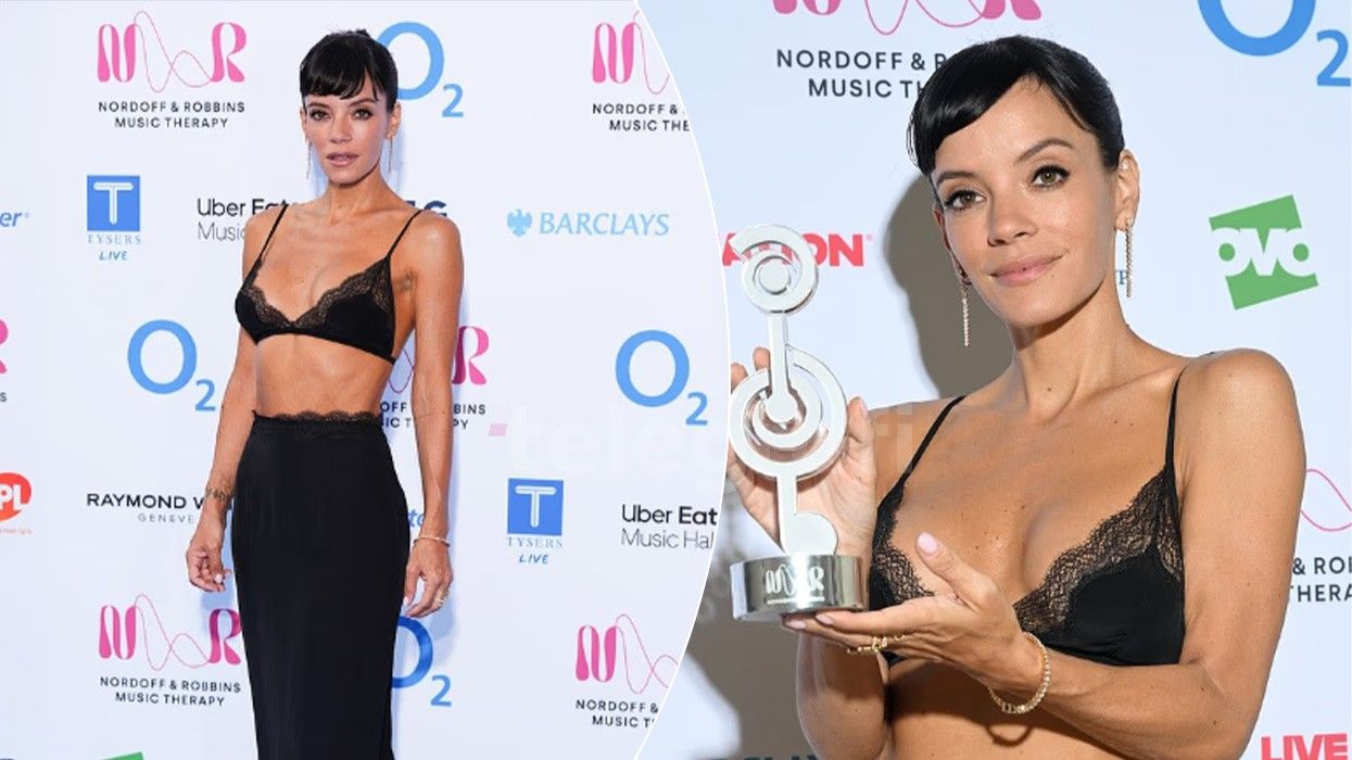 Lily Allen nderohet si ikonë, por është paraqitja e saj ajo që rrëmben vëmendjen Lily Allen nderohet si ikonë, por është paraqitja e saj ajo që rrëmben vëmendjen