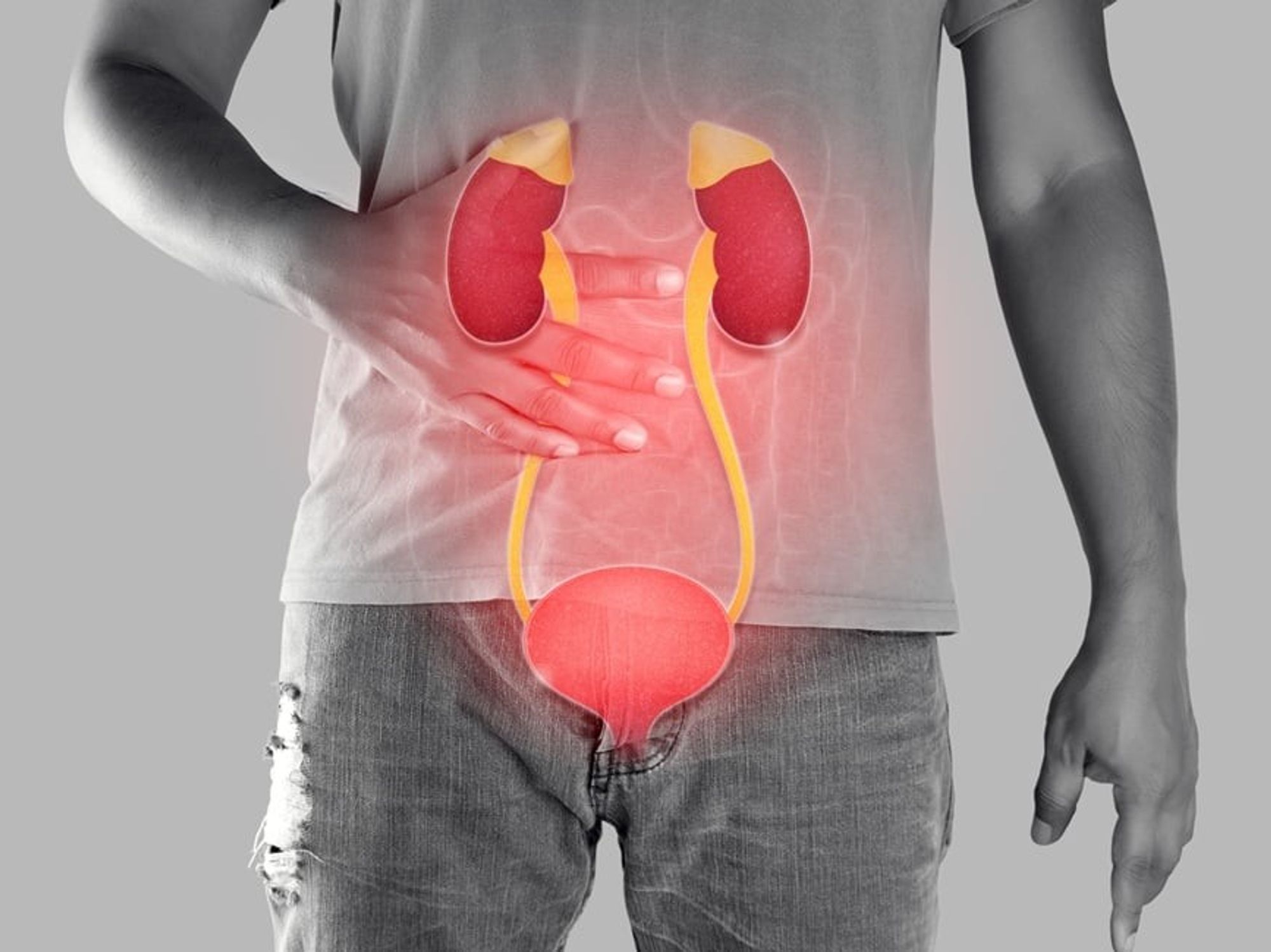 Si ta mbroni shëndetin e veshkave nëse keni kancer metastatik të fshikëzës urinare? Si ta mbroni shëndetin e veshkave nëse keni kancer metastatik të fshikëzës urinare?