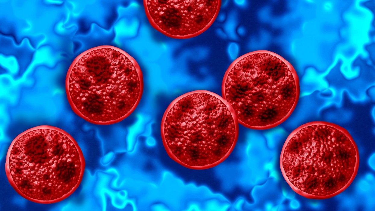 Çfarë është Cyclospora? Dy vdekje në SHBA, shpërthimi i sëmundjes e vë Evropën në gatishmëri