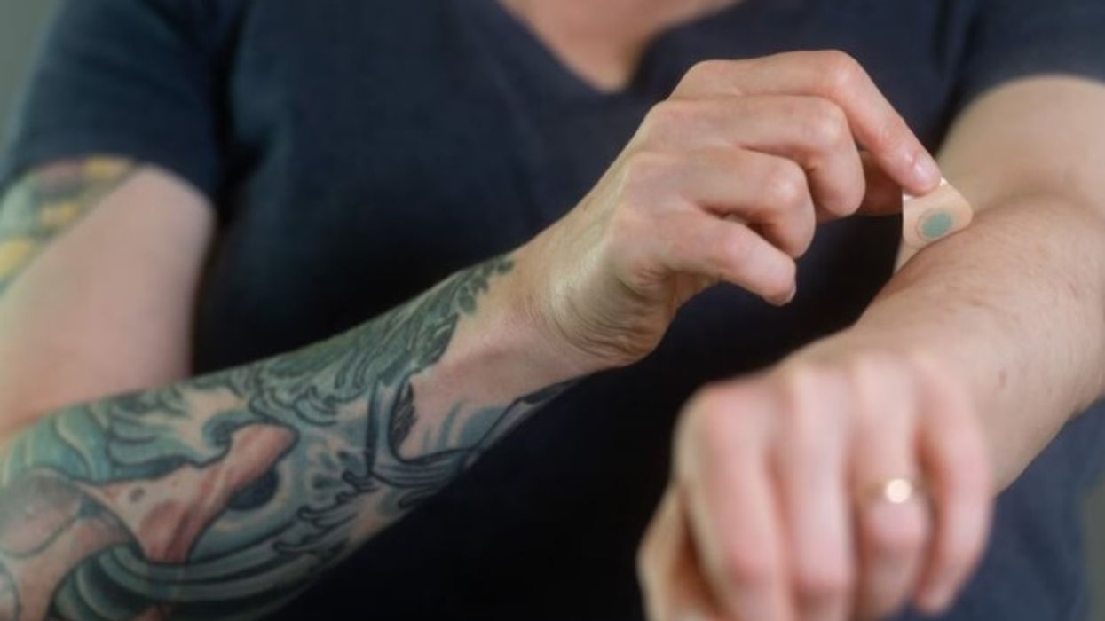 Prezantohet sistemi i parë në botë për tatuazhe të përhershme pa dhimbje Prezantohet sistemi i parë në botë për tatuazhe të përhershme pa dhimbje