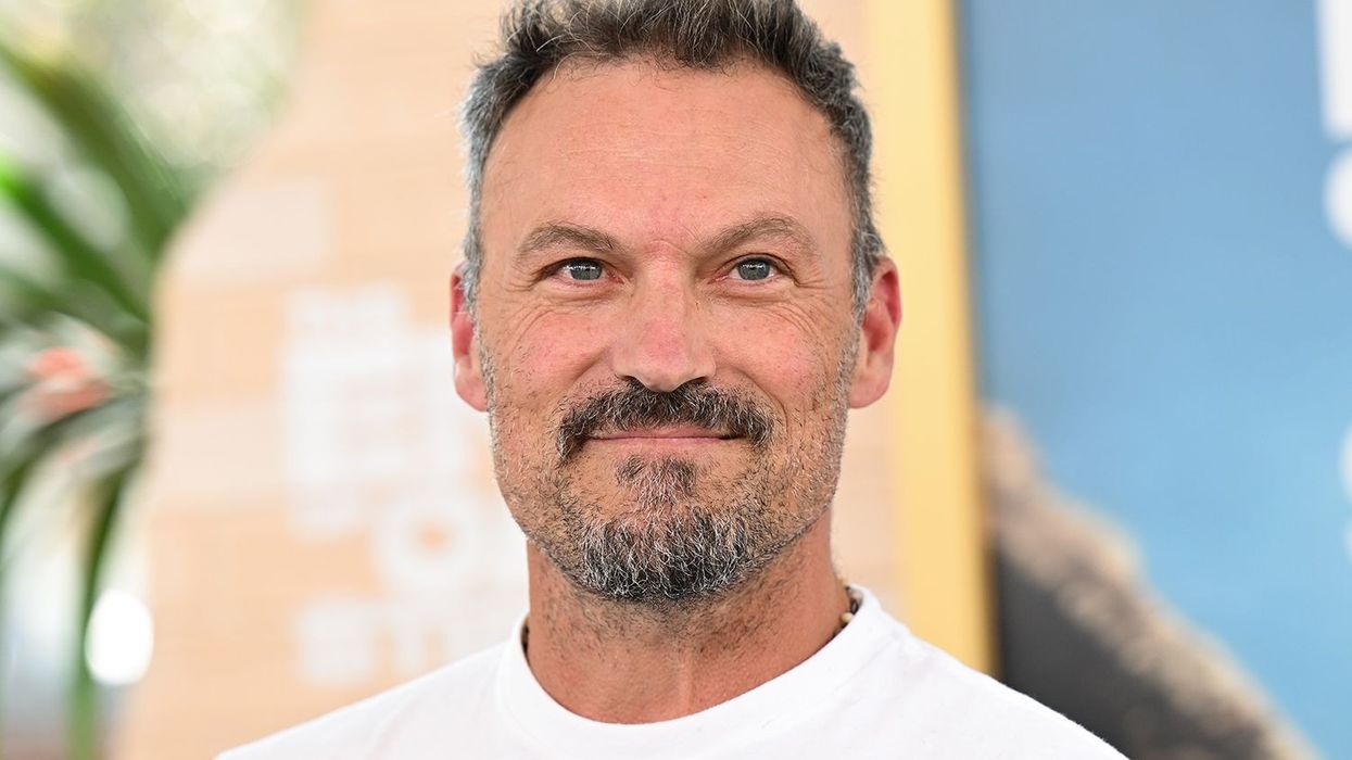 Brian Austin Green zbulon detajet e një sëmundjeje të rëndë: Më është dashur të mësoj të ecë dhe të flas përsëri Brian Austin Green zbulon detajet e një sëmundjeje të rëndë: Më është dashur të mësoj të ecë dhe të flas përsëri