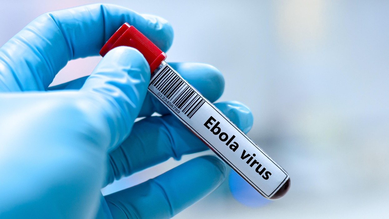 Ebola vijon të përhapet në Kongo, gati 3 mijë viktima